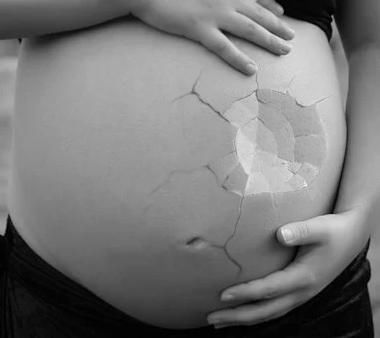 胎停育的现象并不少见，避免这些因素是关键！