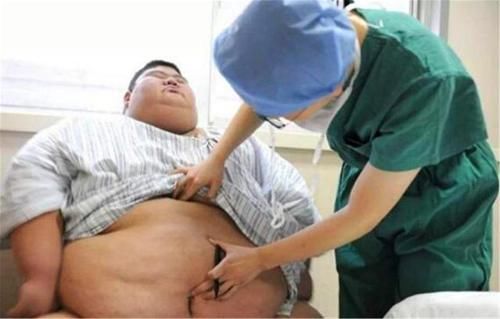 中国第一胖王浩楠：一年减掉363斤，健身房里还收获一段爱情