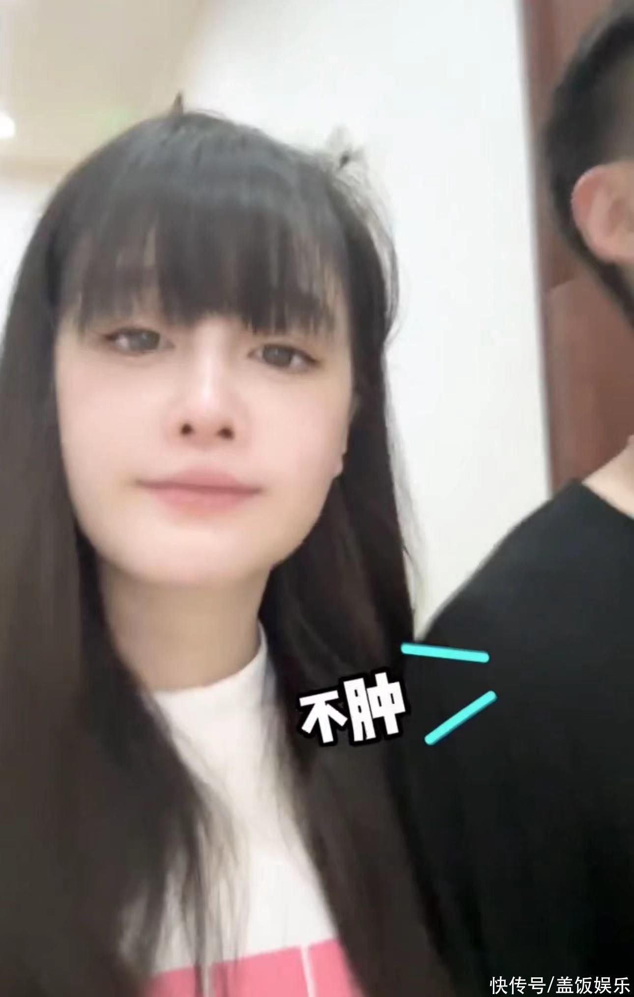 赵本山女儿已怀孕3月!晒宝宝b超照显兴奋,曝孕反严重呕吐浑身疼