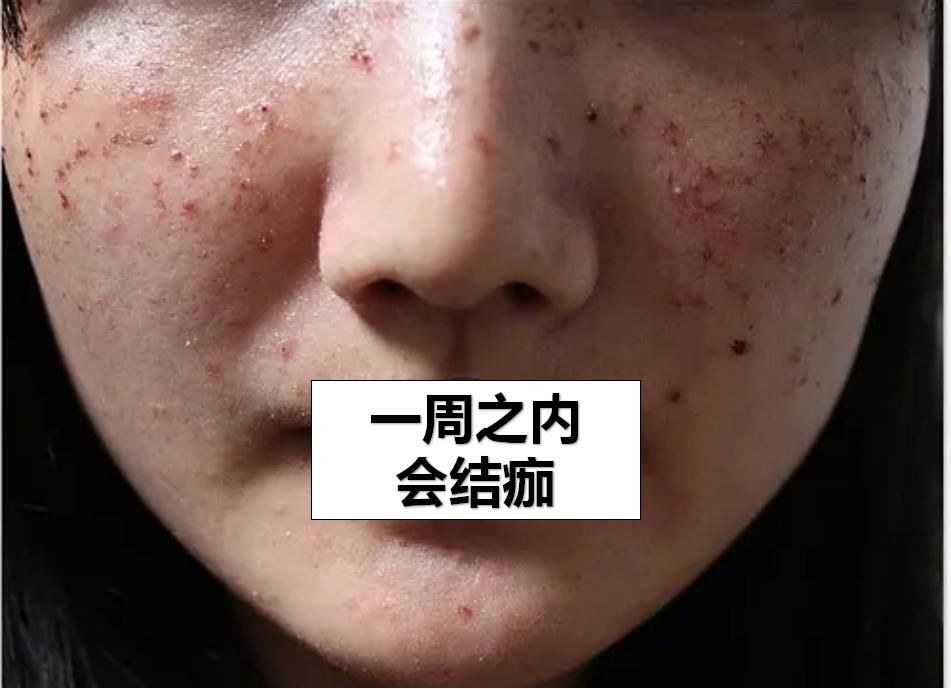 美到甘愿被她抢老公，王思聪新盯上的女友到底赢在哪？